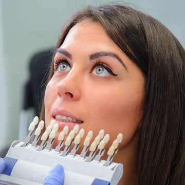 7 Reasons Why Dental Veneers Have Become So Popular