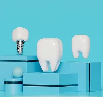 Dental Implants Explained: How Do They Work? Are they Safe?