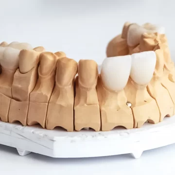 Give Your Teeth a Classic Appearance They Deserve with Dental Veneers