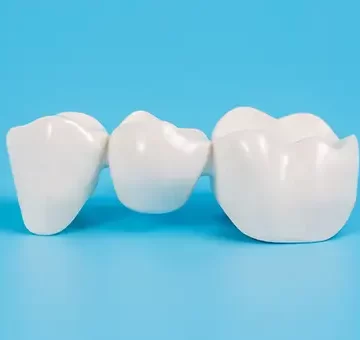 What Are Dental Bridges and Why May You Need Them