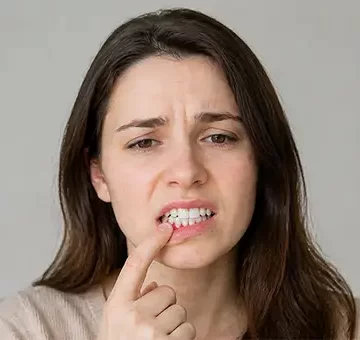 4 Important Facts to Know about Gum Grafting