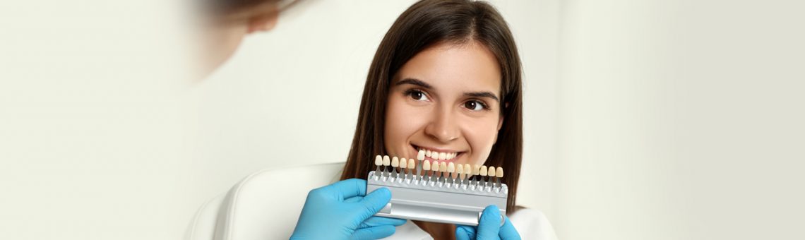 What are Dental Veneers Types, Procedure & Benefits?