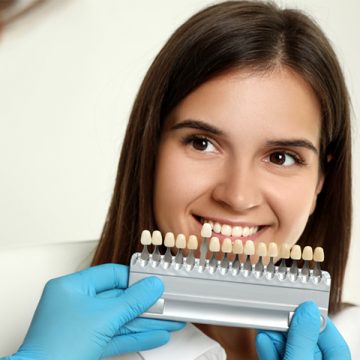 What are Dental Veneers Types, Procedure & Benefits?