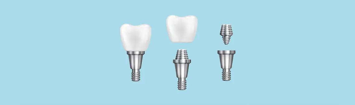 What are Dental Implants: Procedure, Benefits, and Aftercare Tips