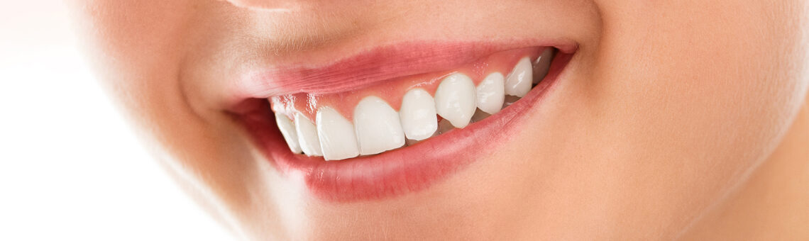 Why You Should Consider Teeth Whitening: Top 5 Reasons