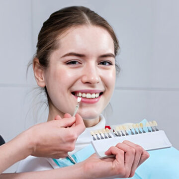 Is It Time to Replace Your Dental Veneers?
