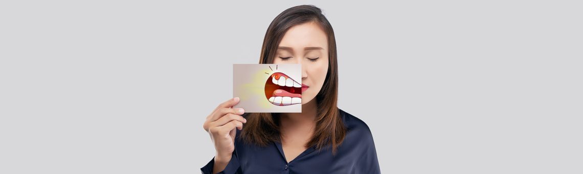 What Is Gum Grafting? A Complete Guide for Patients