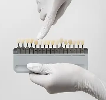 7 Smile Problems Dental Veneers Can Solve Instantly