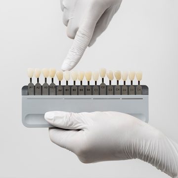 Can Dental Veneers Blend Naturally with Your Front Teeth?