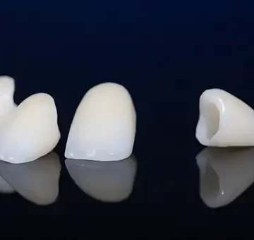 Dental Crowns vs Bridges: Which is Right for You?