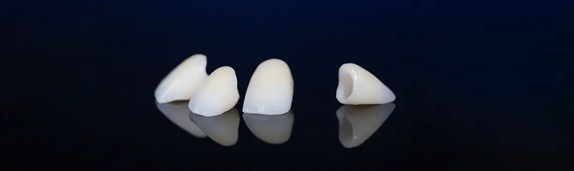 Dental Crowns vs Bridges: Which is Right for You?